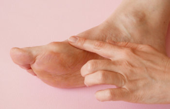 woman is hand massaging her bunion toes in bare feet