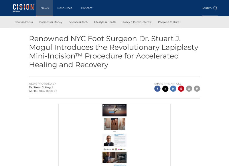 Screenshot of an article - Renowned NYC Foot Surgeon Dr. Stuart J. Mogul Introduces the Revolutionary Lapiplasty Mini-Incision™ Procedure for Accelerated Healing and Recovery